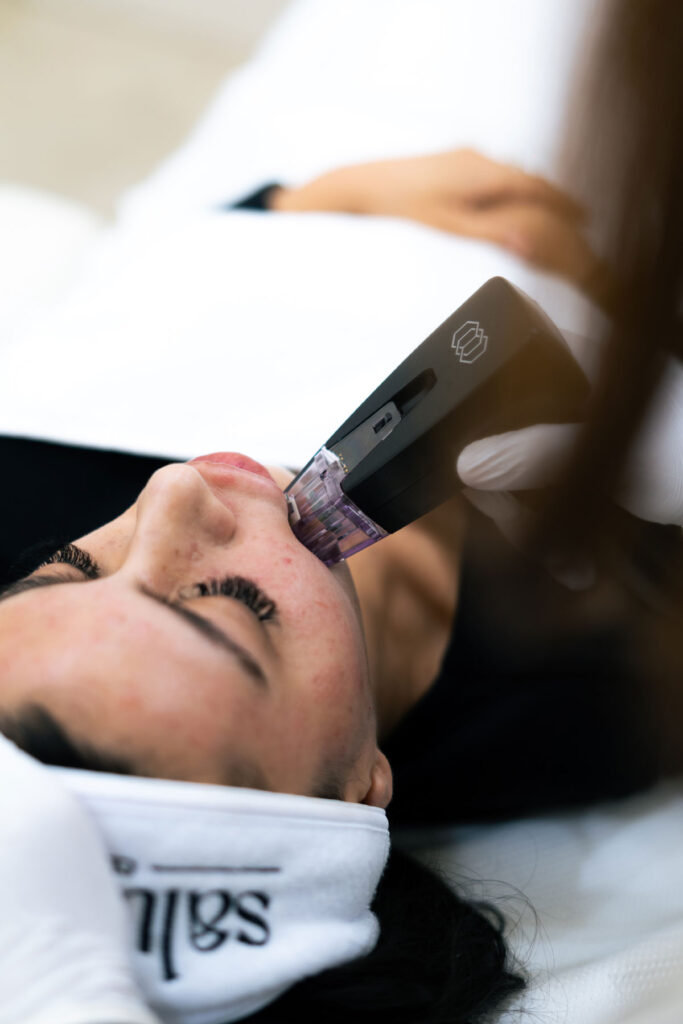 Salus Clinic Morpheus8