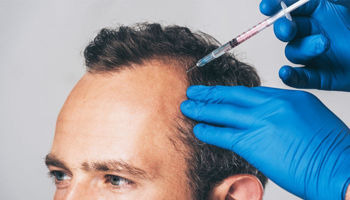 PRP Hair Salus Clinic Dubai