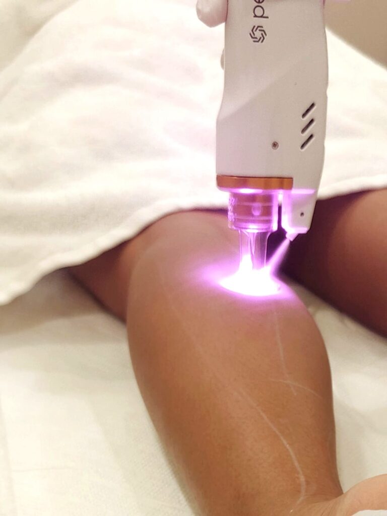 Laser Hair Removal Salus Clinic