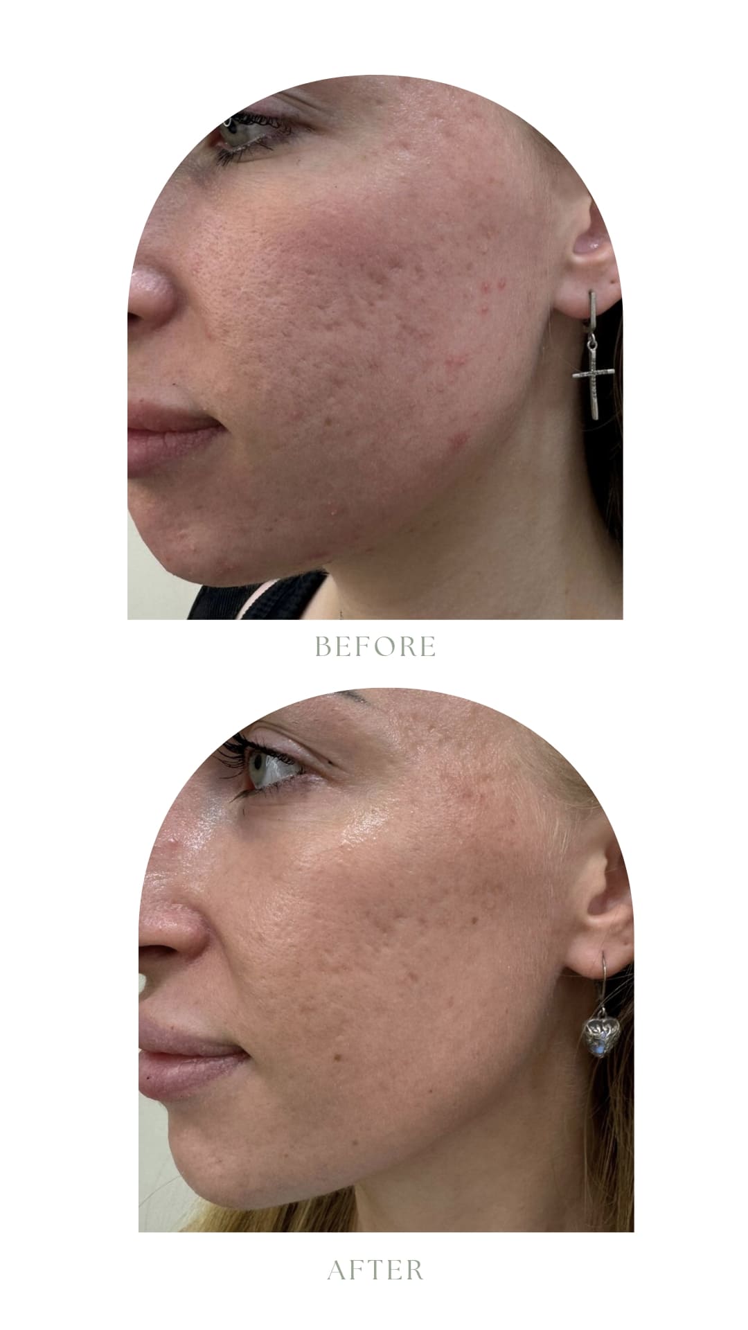 D4C0ECCD-5FF3-40FA-97A4-72CD089B3F74