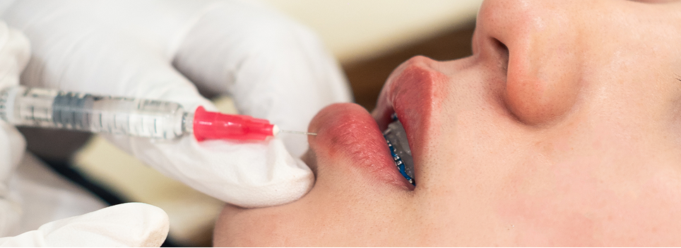 Lip Filler Session