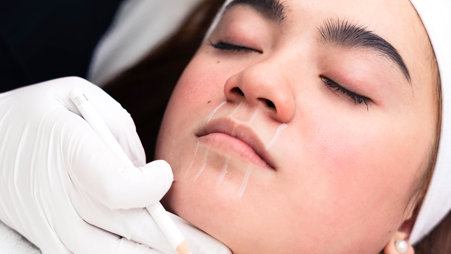 are lip fillers safe